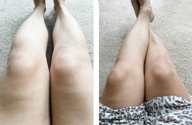 Legs before and after sunless tanner 