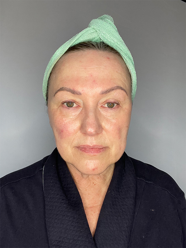 Woman with blotchy skin to learn how to apply foundation